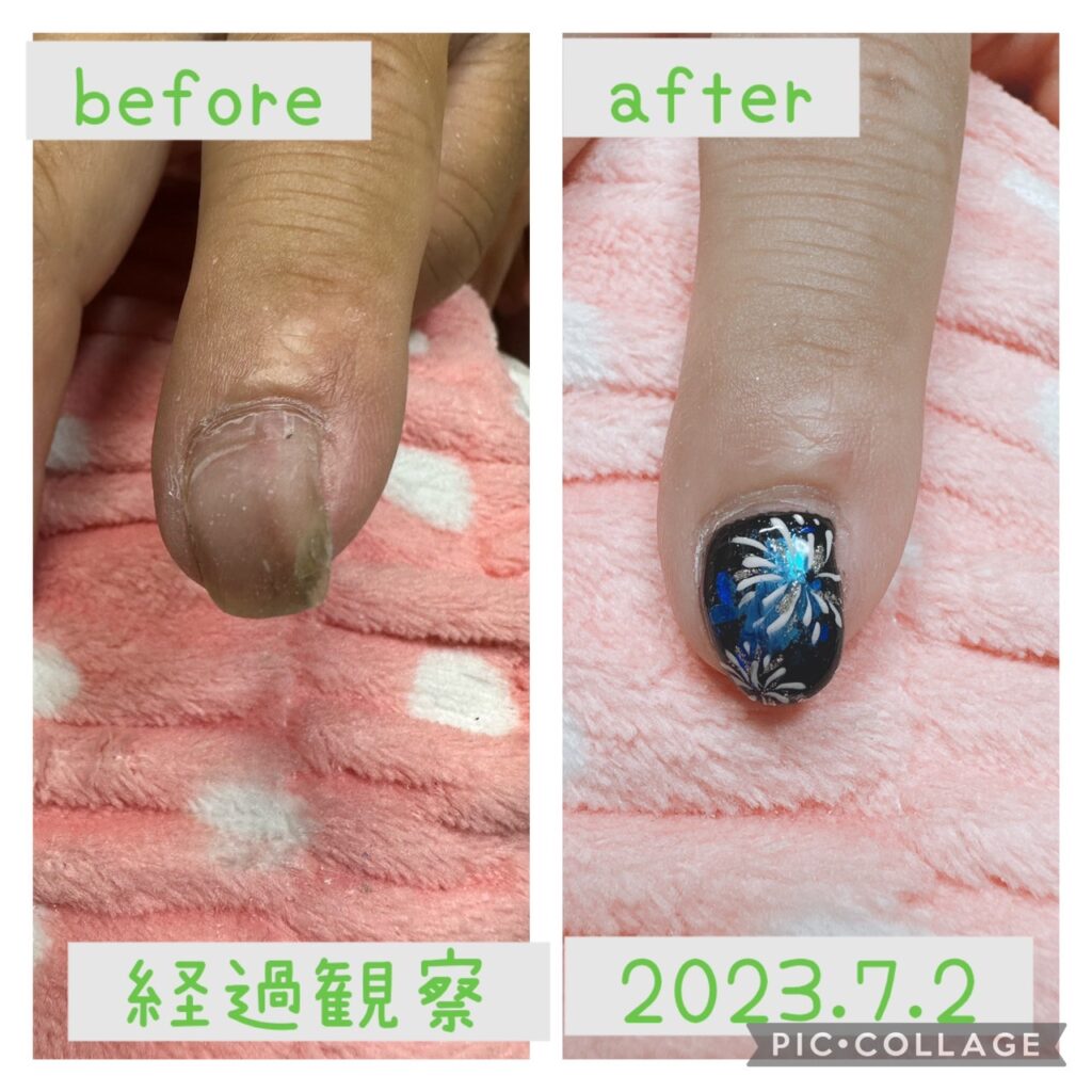 Nail No.1329