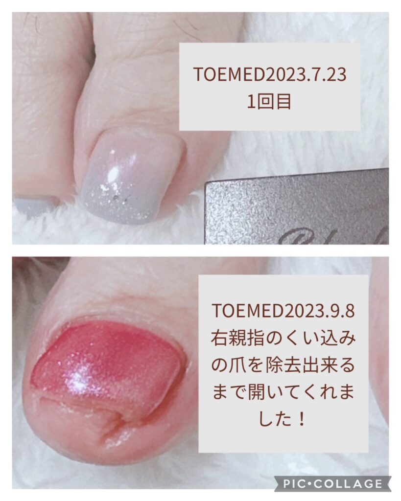 Nail No.1498