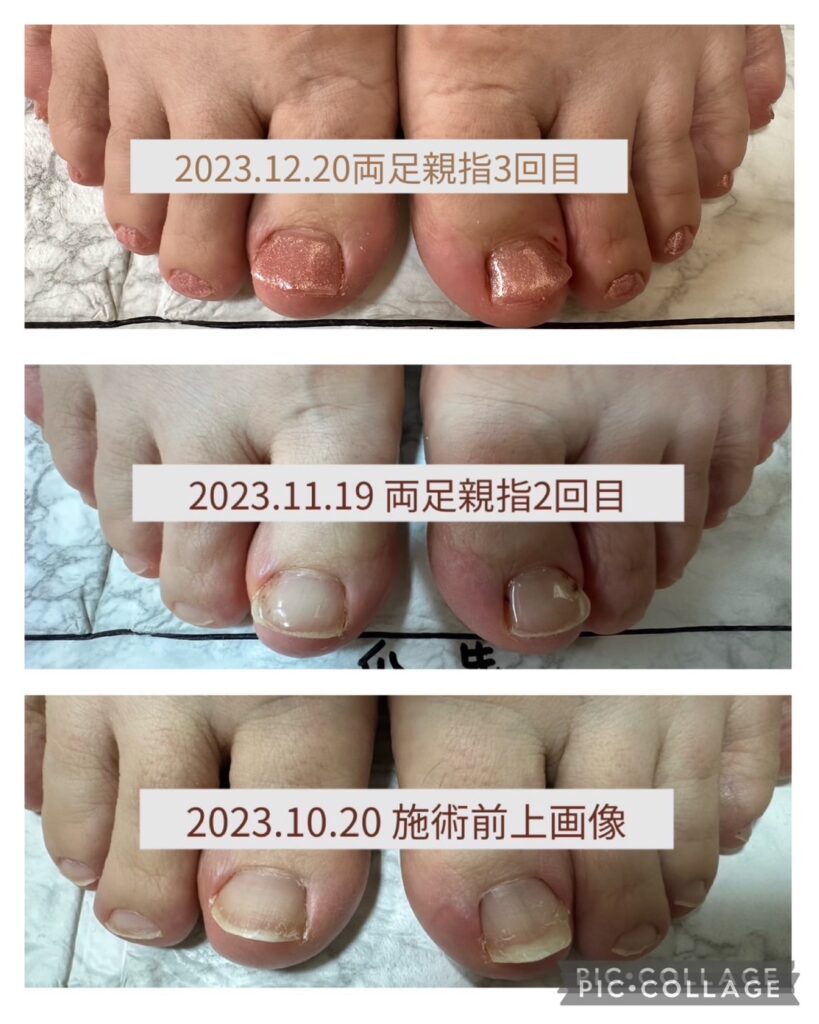 Nail No.1734