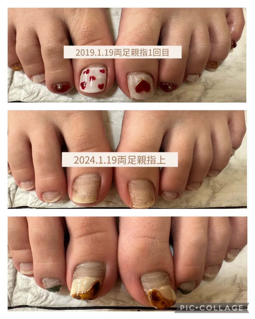 Nail No.1819