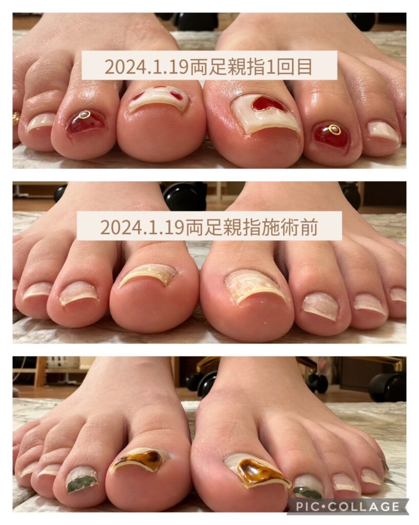 Nail No.1820