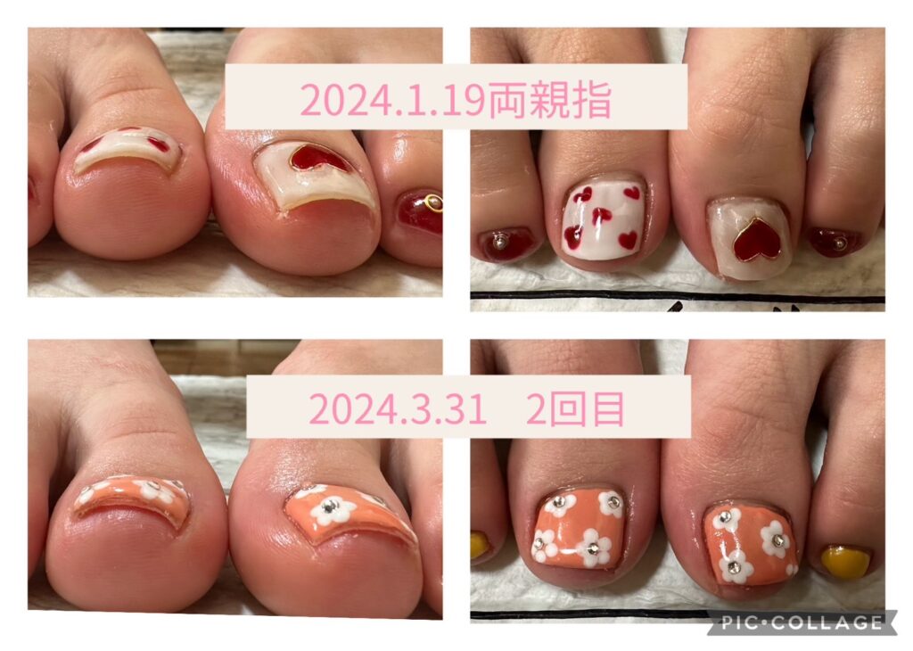 Nail No.1995