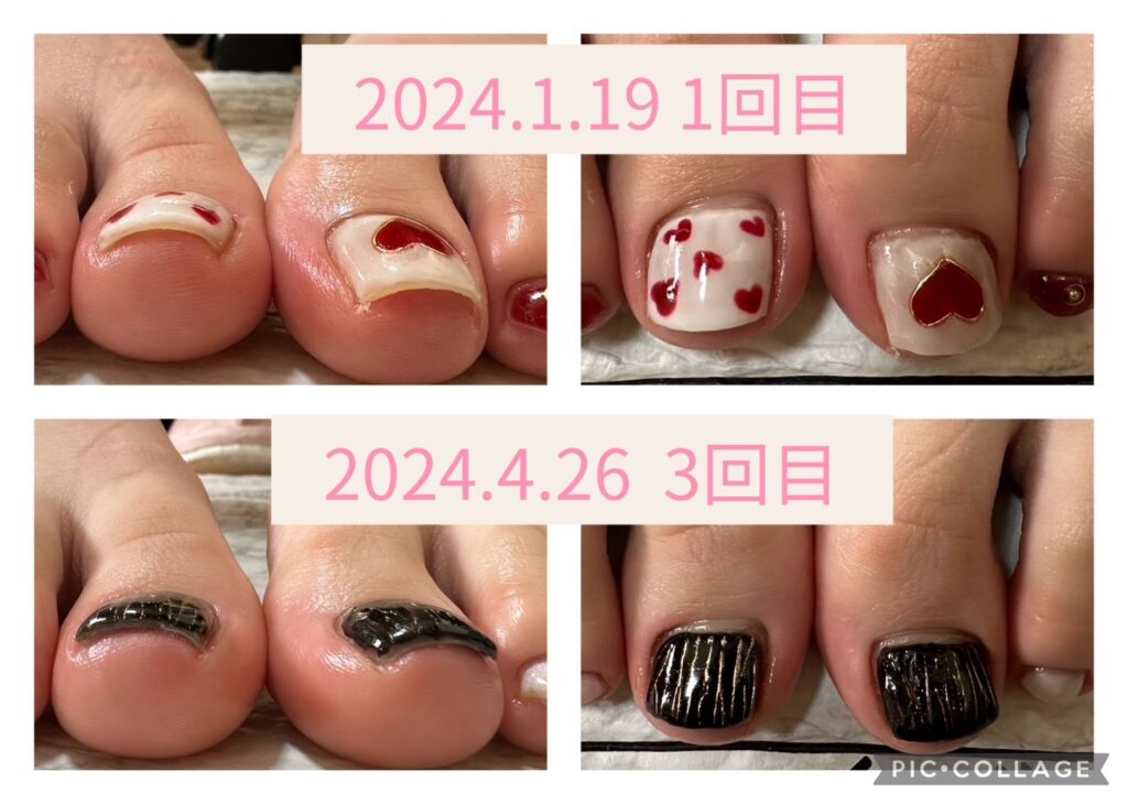 Nail No.2056