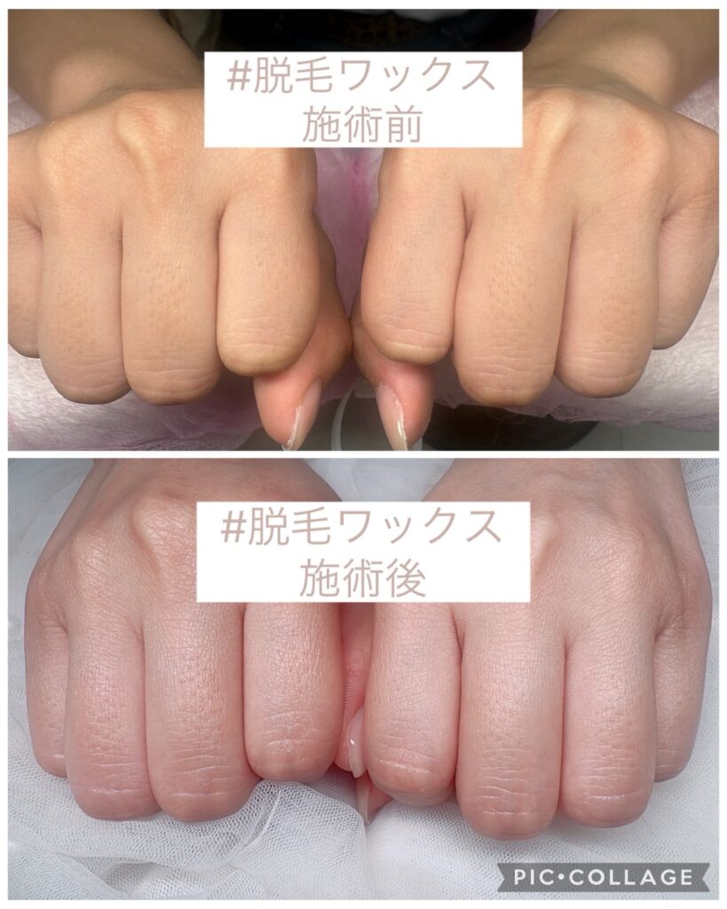 Nail No.4164【脱毛ワックス施術】