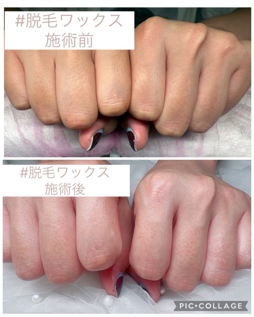 Nail No.4166【脱毛ワックス施術】